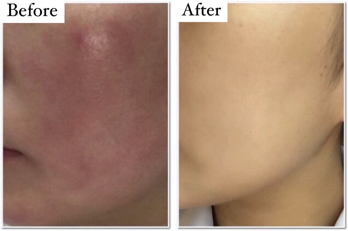 施術事例 Before After